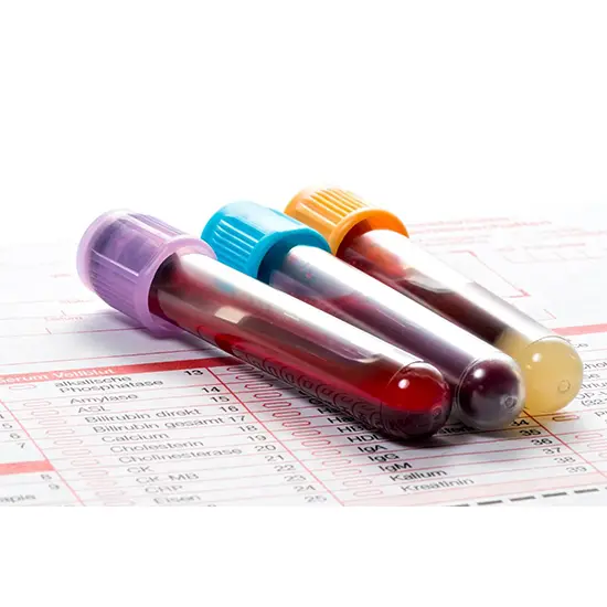Measles PCR - Qualitative